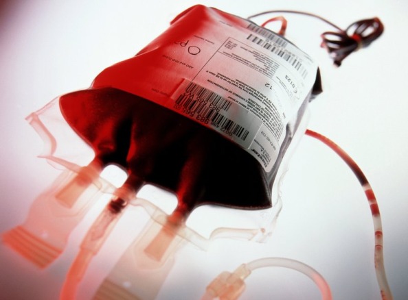 trasfusione-sangue
